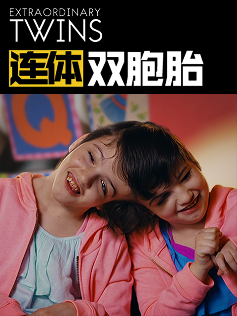 连体双胞胎封面图